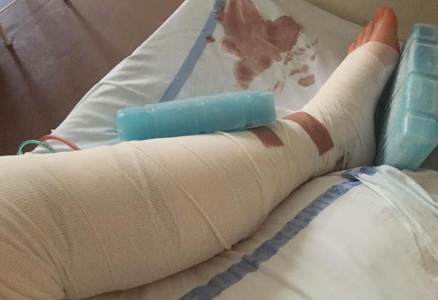 Szegény lábam - nem hittem, hogy idén nyáron bakancs helyett kötés lesz rajta